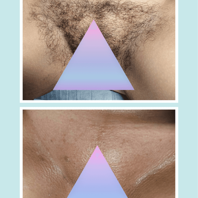 Unlimited Brazilian Wax Package at Bare+ Skincare By Miranda in York, PA